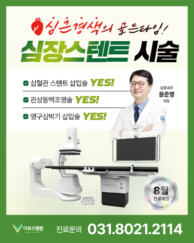 팝업